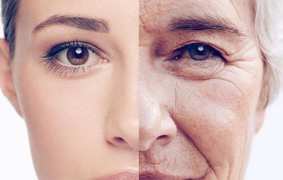 Làn da bị lão hóa, chảy sệ do suy giảm collagen