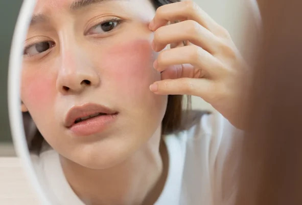 Da nhạy cảm có thể xuất hiện trên nhiều vùng da nhưng dễ thấy nhất là vùng da mặt