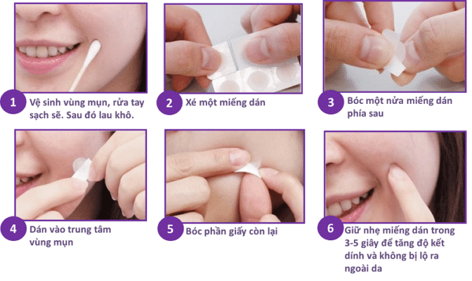dùng miếng dán mụn đúng cách