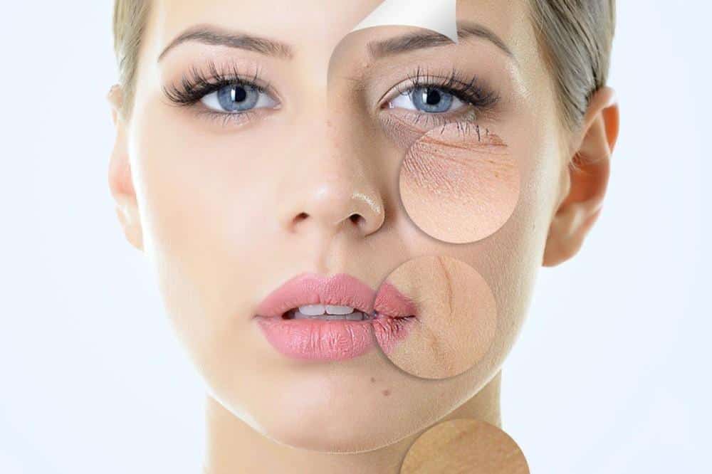 Một phương pháp để chống lão hóa da đó chính là sử dụng các sản phẩm có chứa hoạt chất Retinol