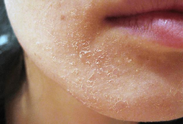 Retinol không bong tróc nội địa Đức