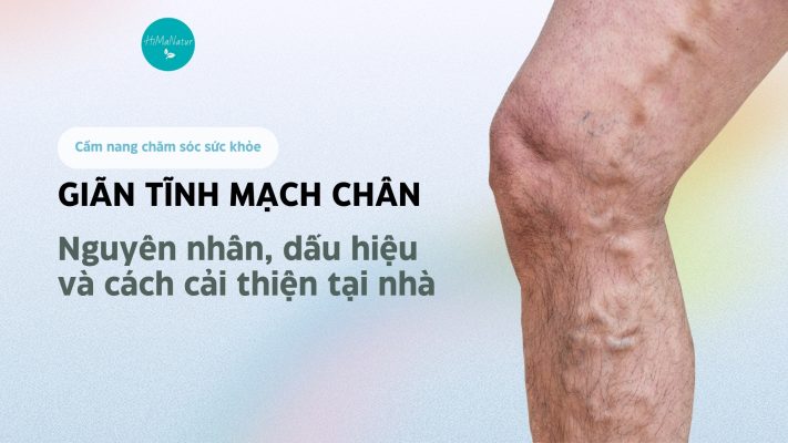 giãn tĩnh mạch chân kem bôi giãn tĩnh mạch đức
