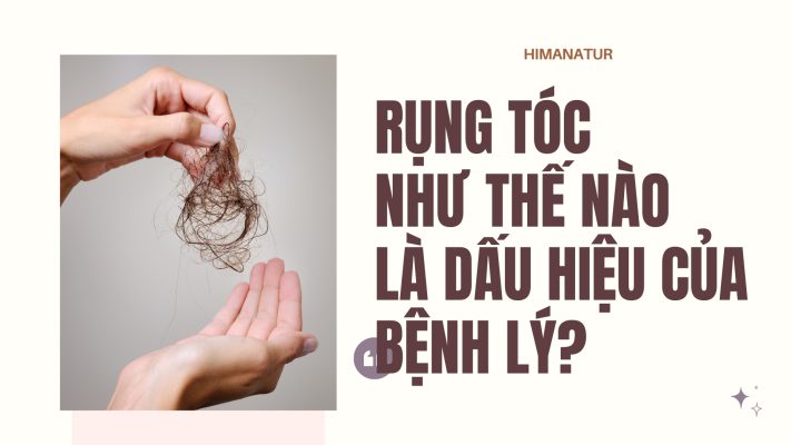 rụng tóc chăm sóc tóc