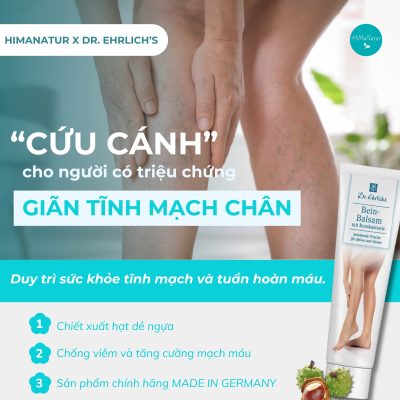 giãn tĩnh mạch chân