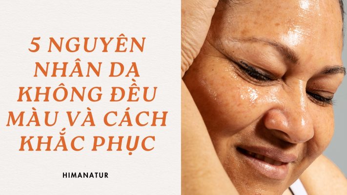 da không đều màu