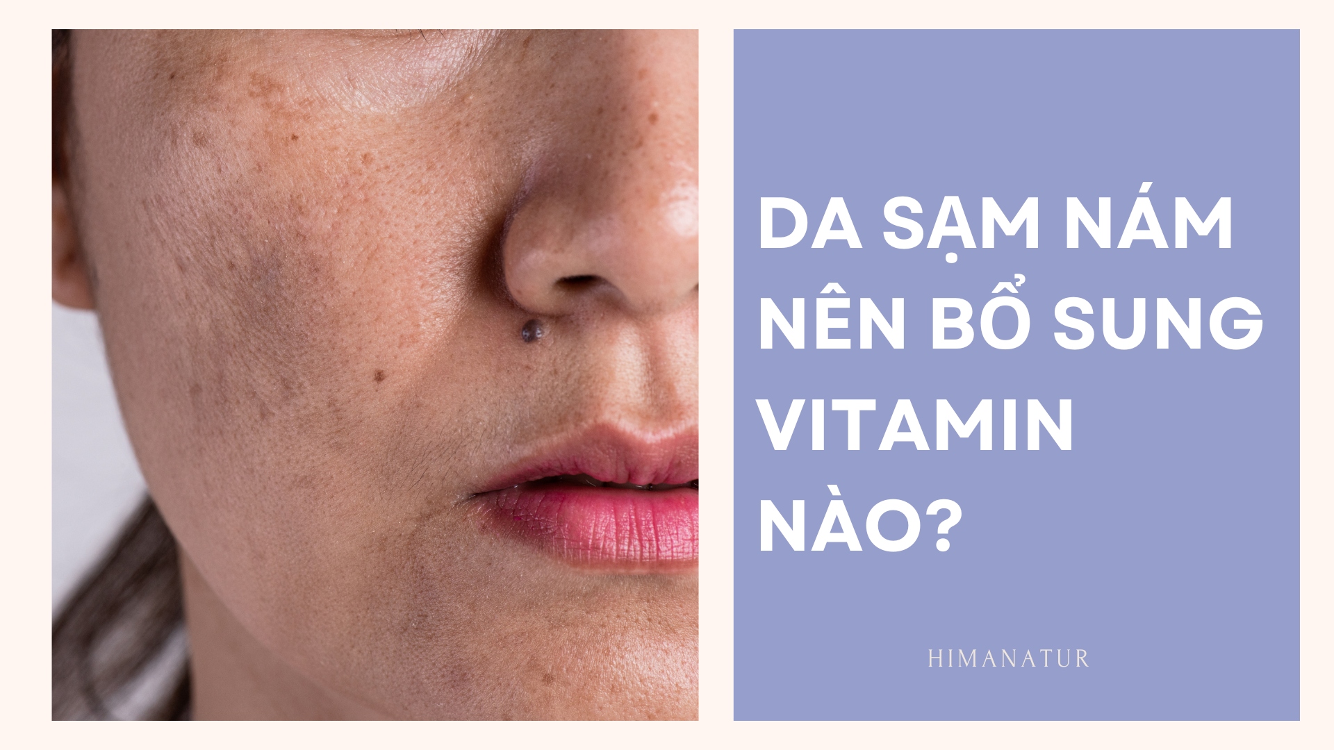 DA SẠM NÁM